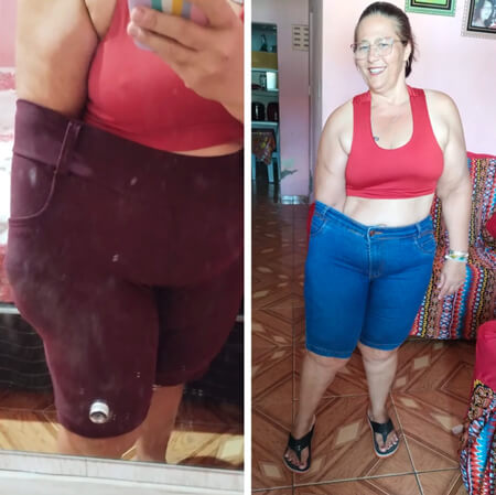 Antes e depois de paciente