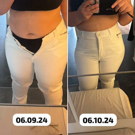 Antes e depois de paciente
