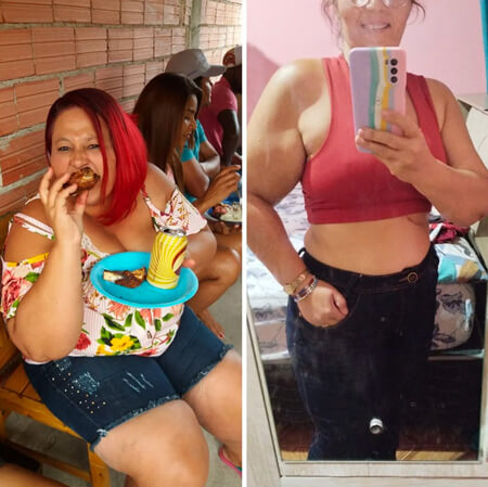 Antes e depois de paciente