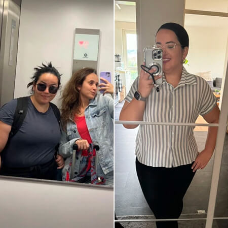 Antes e depois de paciente